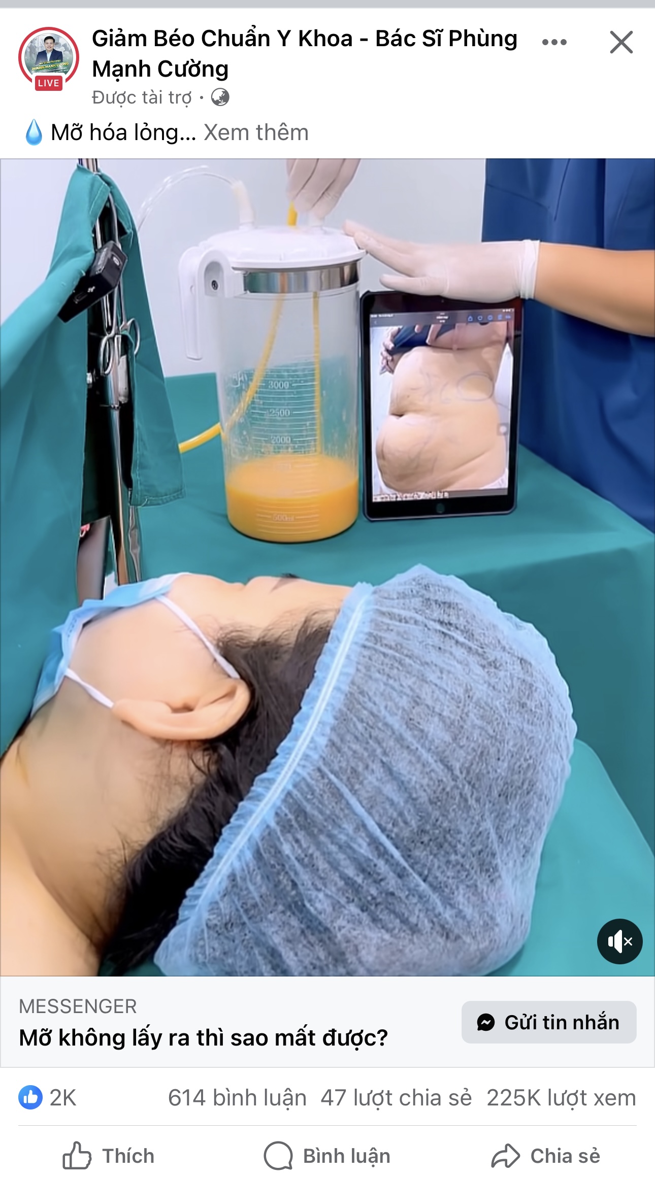 Quảng cáo giảm béo như nấm mọc sau mưa trên mạng xã hội liệu có đáng tin cậy?